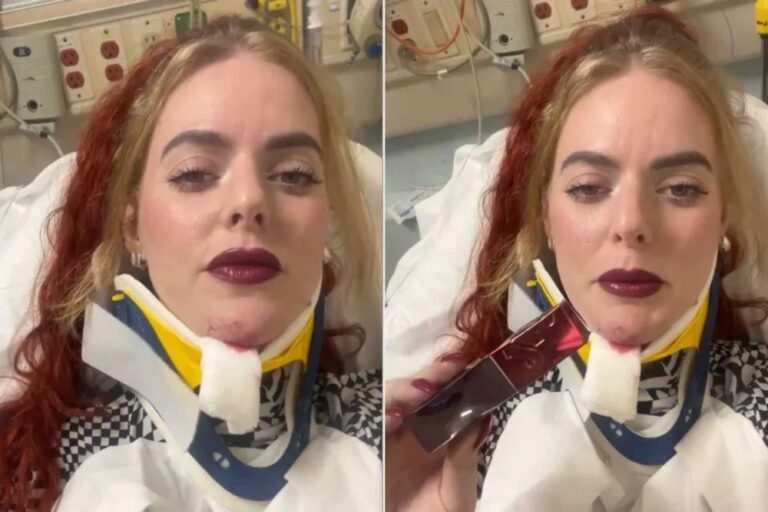 Brooklyn Woman’s Lipstick Stays Perfect Even After Bike Crash: “Not One Smudge”