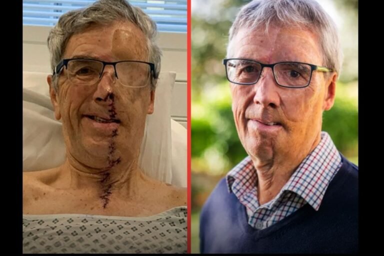 Grandfather Receives First NHS 3D-Printed Face After Horrific Cycling Accident