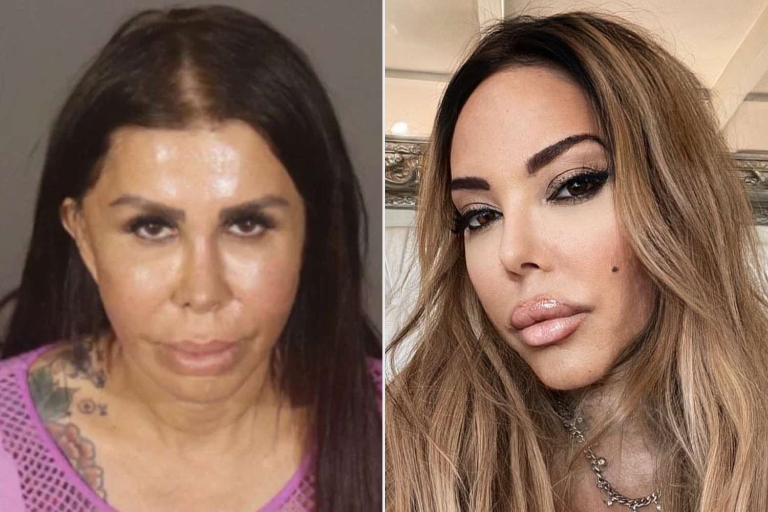 California Woman Sentenced to 15 Years to Life for Illegal Silicone Injection That Killed Hollywood Actress