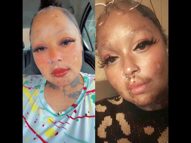 Woman Wrongfully Diagnosed With HIV While Pregnant at Age 19 Before Doctors Eventually Discovered She Had Lupus in a Case Now Inspiring Others to Advocate for Themselves